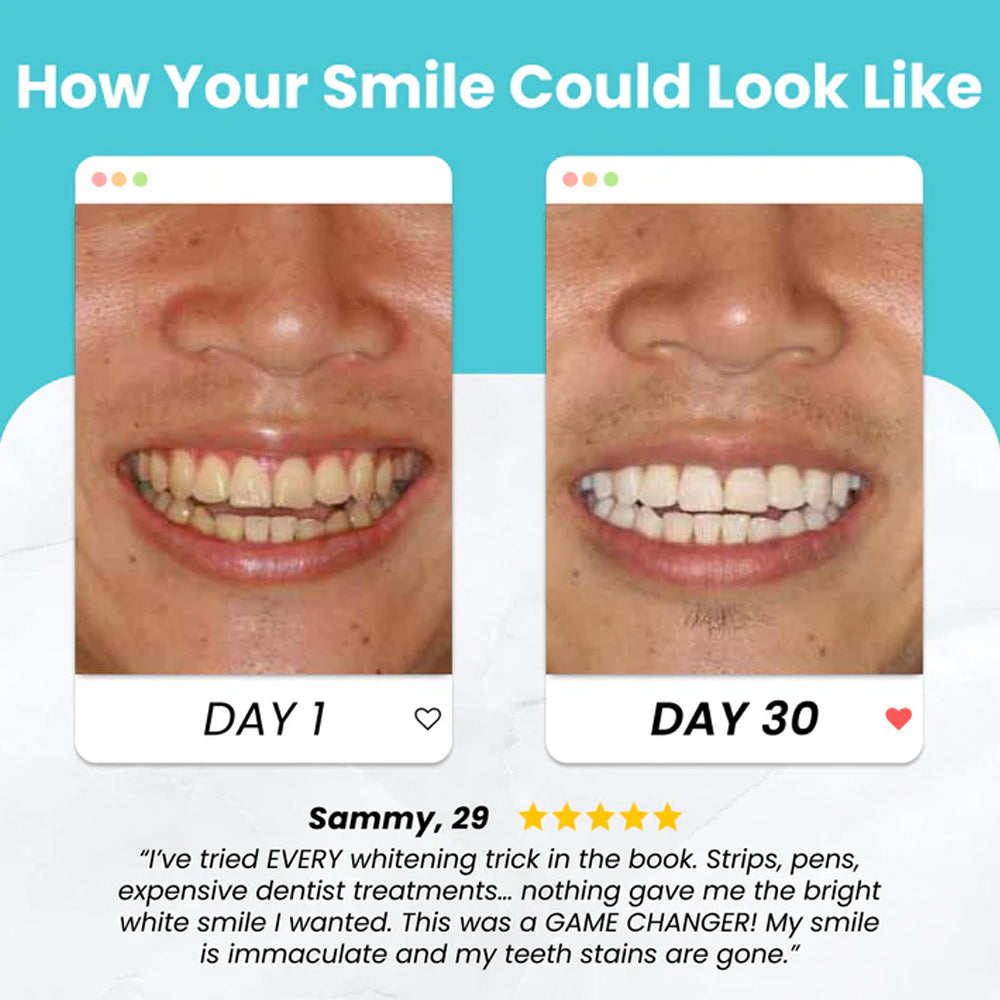 Whoa!🔥 【BUY 1 GET 1 FREE】Brushing your teeth has never been simpler